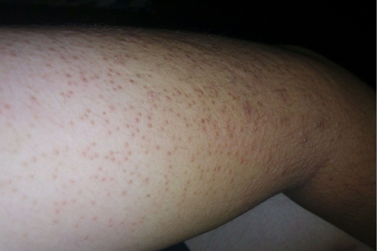 胳膊上的皮肤像生锈图片