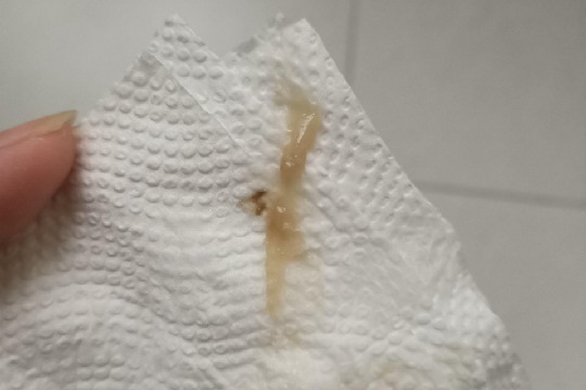 怀孕37周轻微见红图片