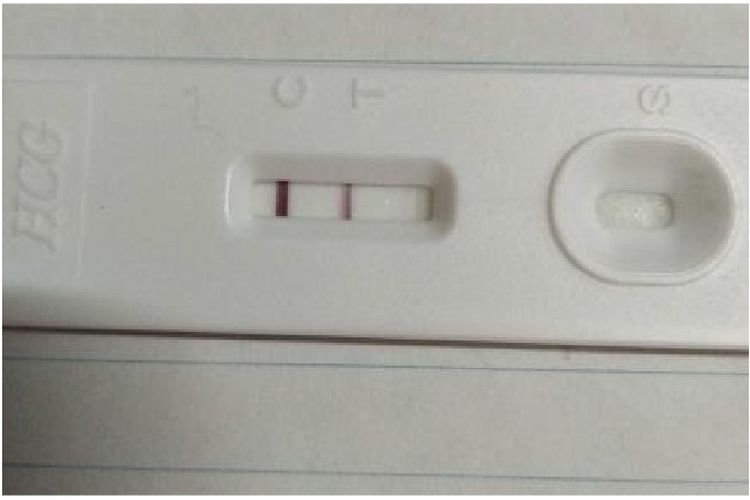 早孕试纸两条红线一深一浅图