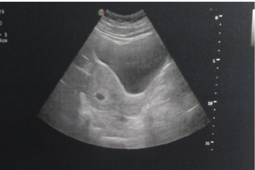 怀孕40天孕囊大小图