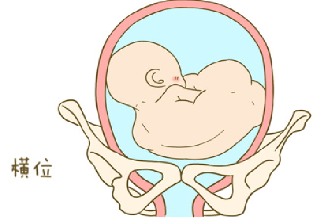 胎儿在子宫的横位图