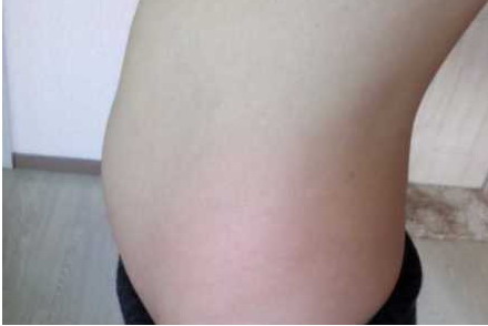 孕16周肚子隆起图片