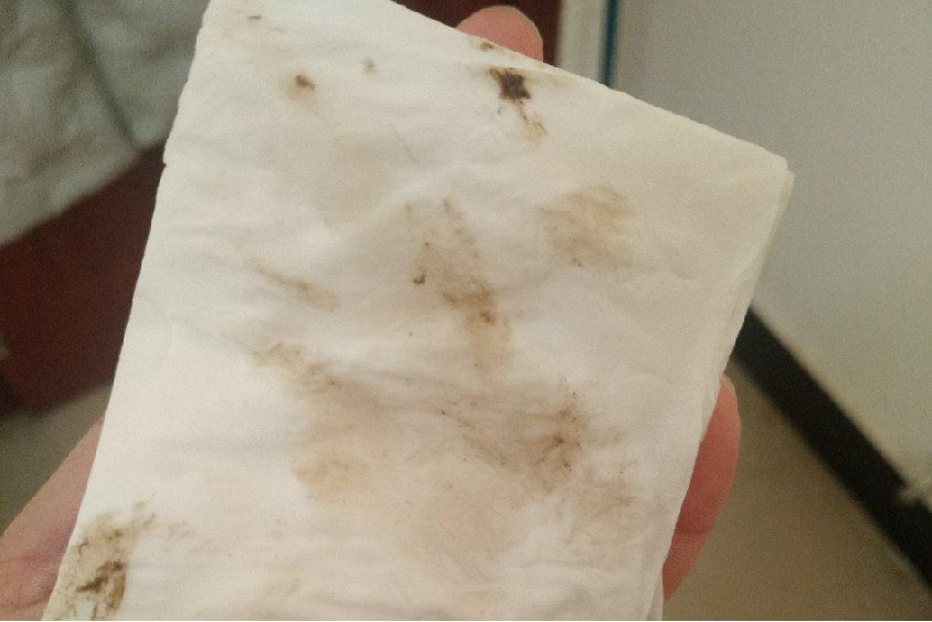 孕50天褐色分泌物图