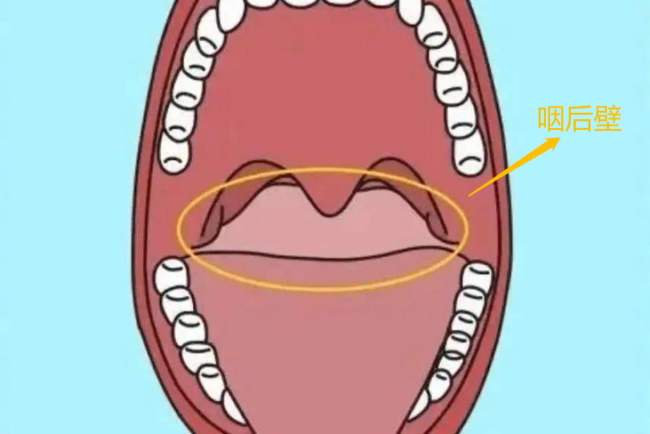 咽后壁位置图