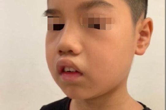 张嘴呼吸变丑图