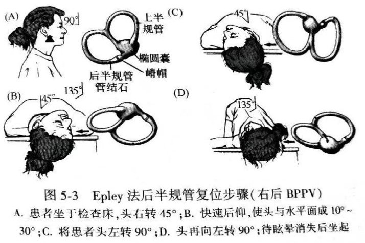 耳石症手法复位图解