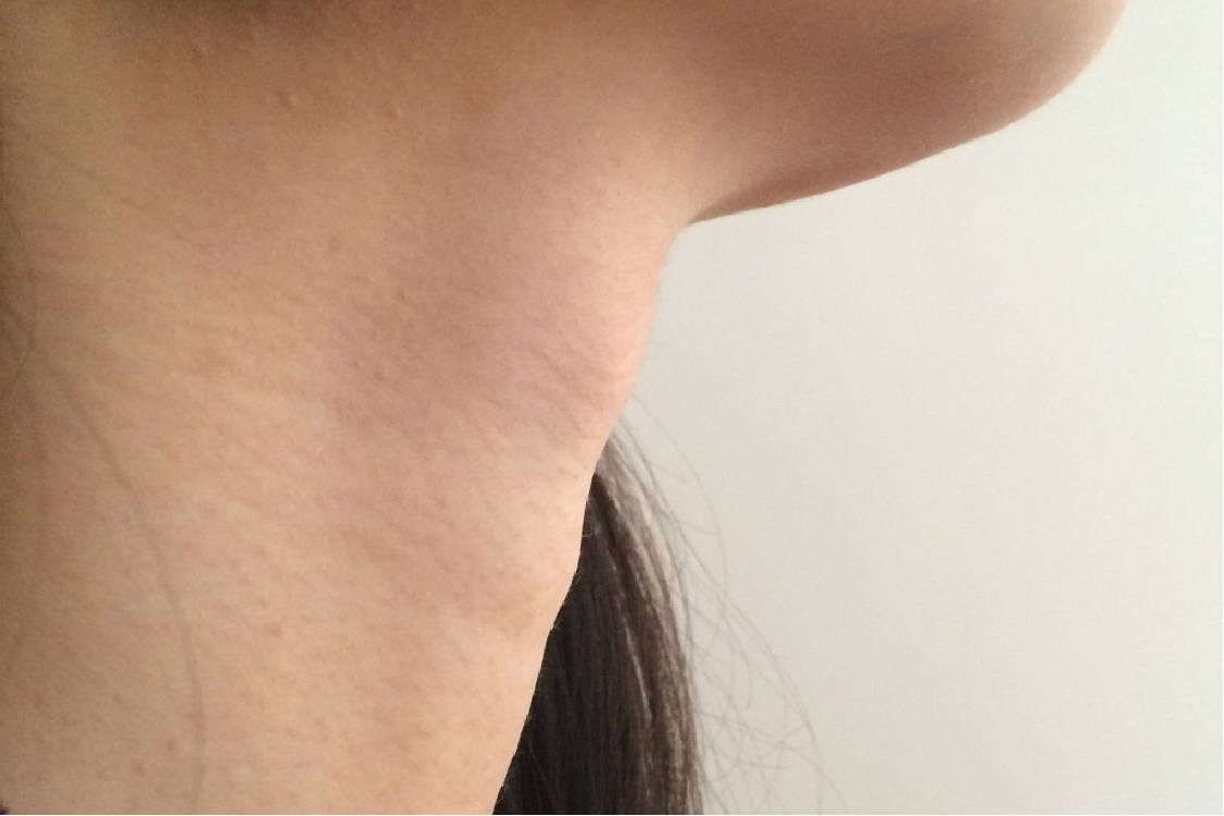 女人正常脖子喉结图片