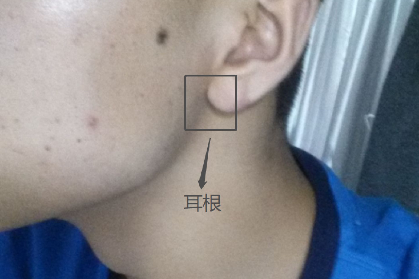 耳根位置图片