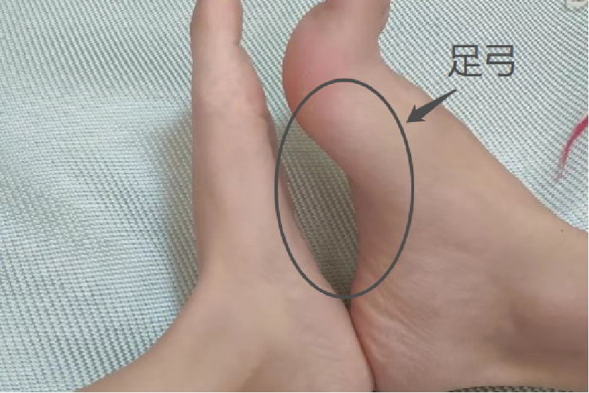 足弓位置图