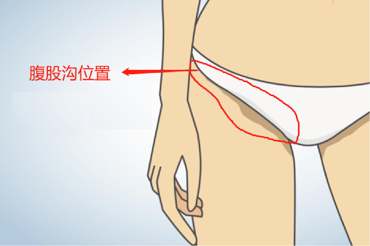 腹股沟位置图