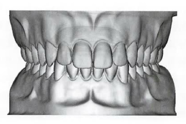 牙齿正确咬合图