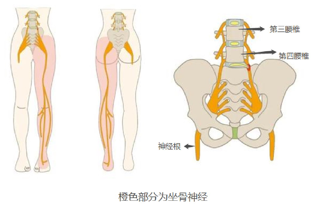女性坐骨神经位置