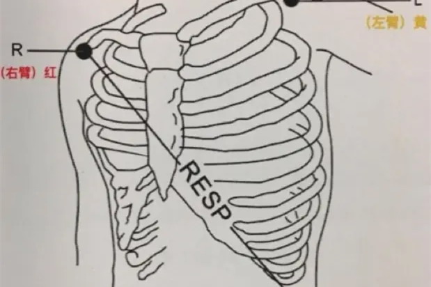 三导联位置图片