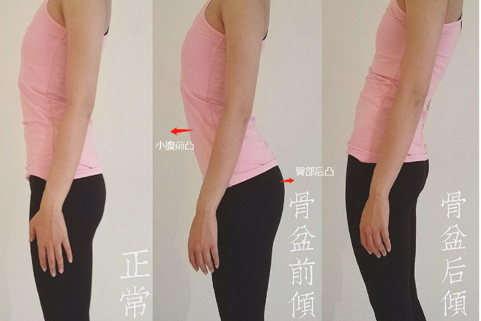 正常与异常骨盆对比图