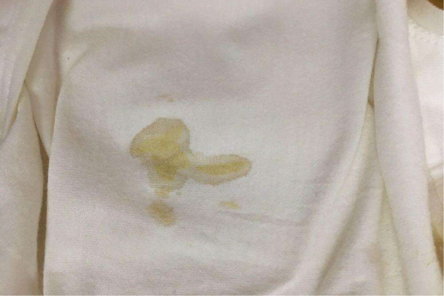 怀孕中期阴道流黄水图