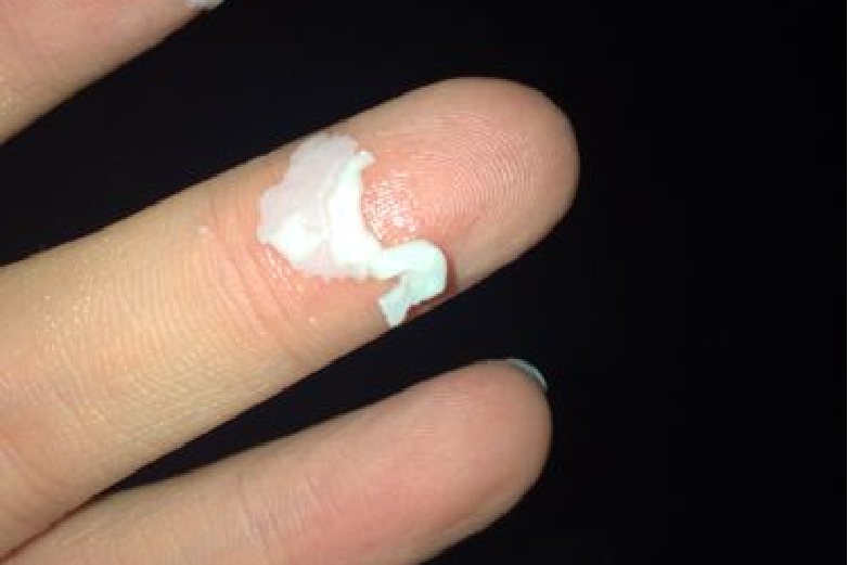 白带像白皮图片