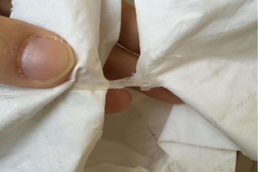 乳白色白带图片