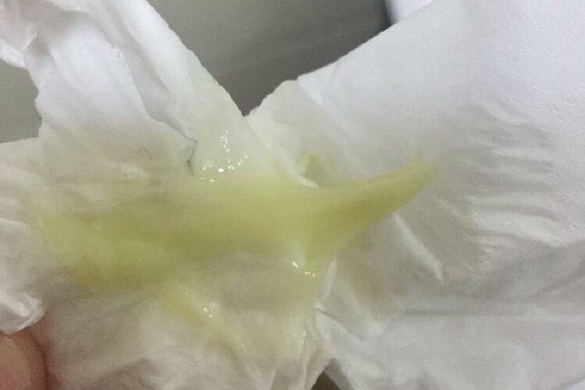 黄绿色白带图片