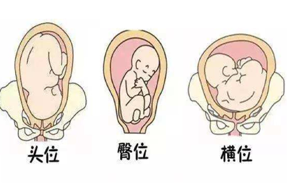 孕晚期胎儿头位图