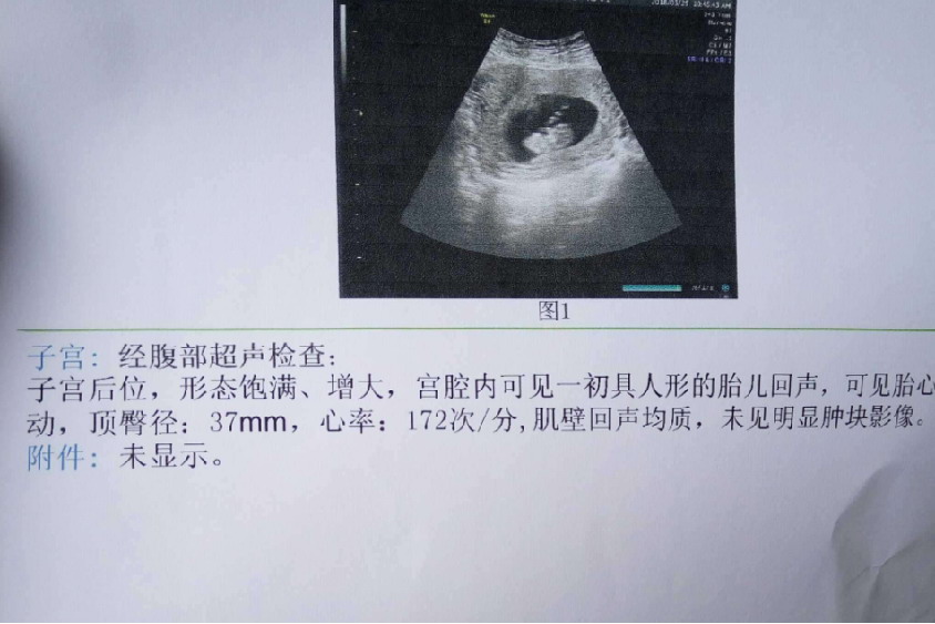 怀孕70天胎儿图
