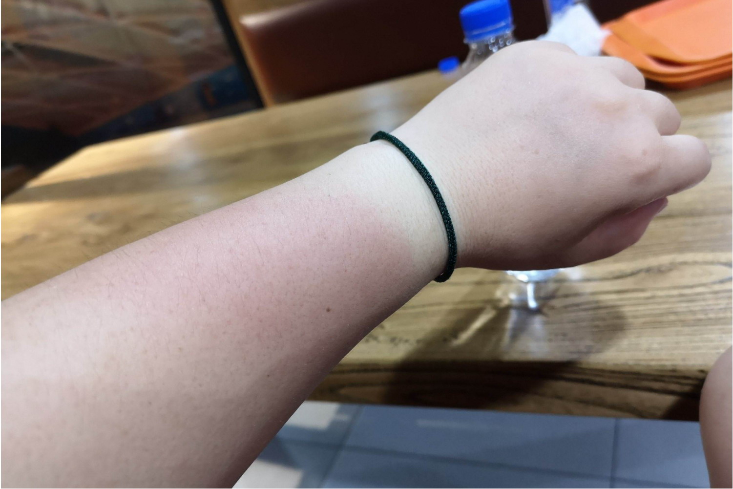 光线性皮肤病图片