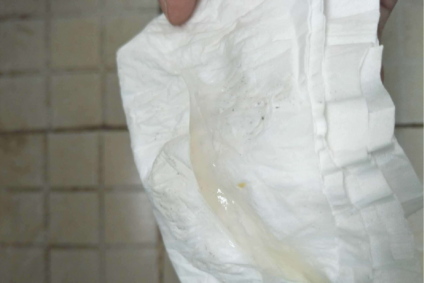 怀孕的白色分泌物图片