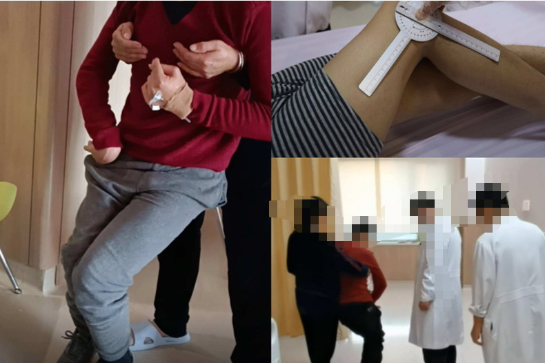 腰椎先天发育不良图