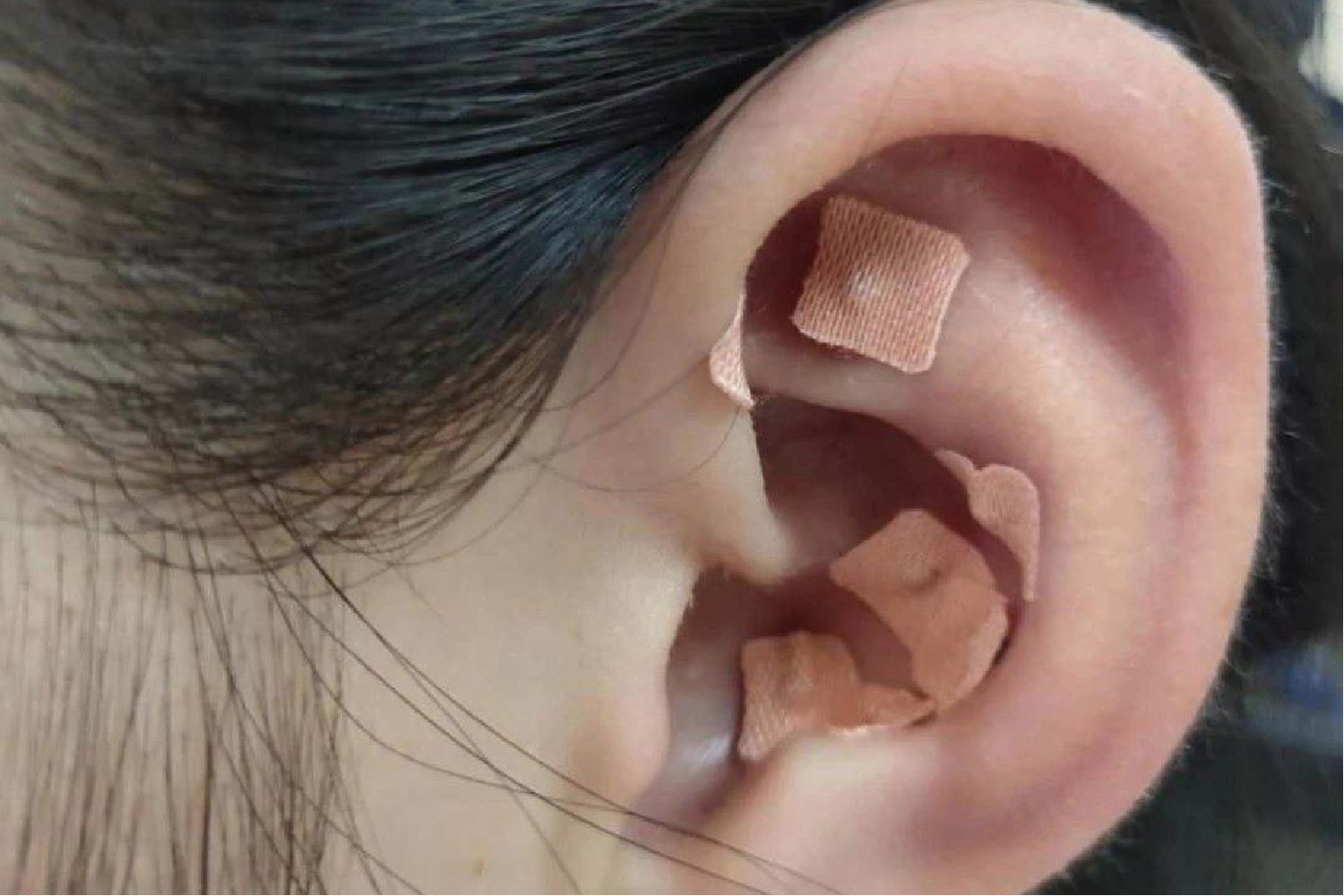 耳穴压豆贴压位置图