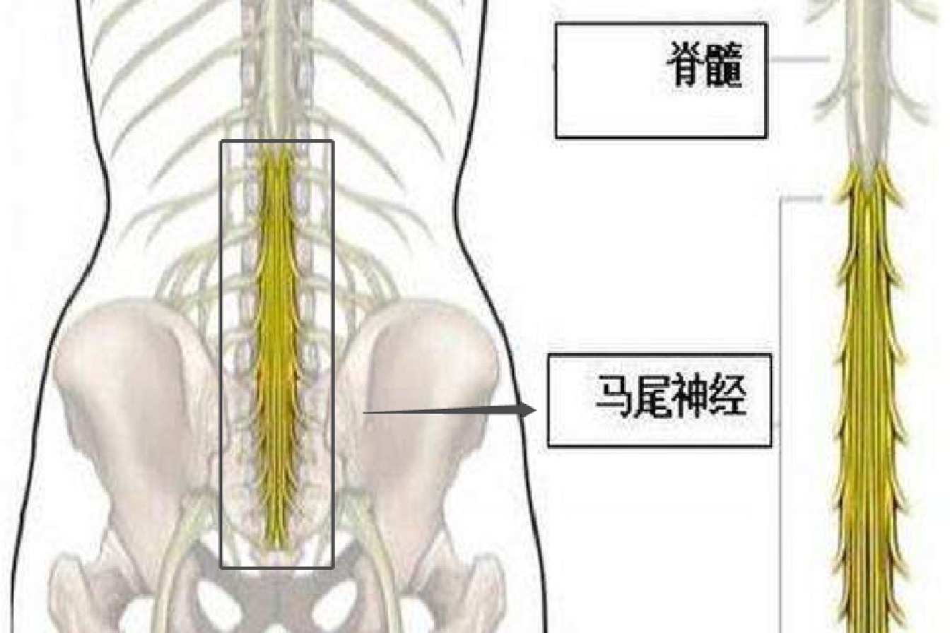 马尾椎神经位置示意图图片