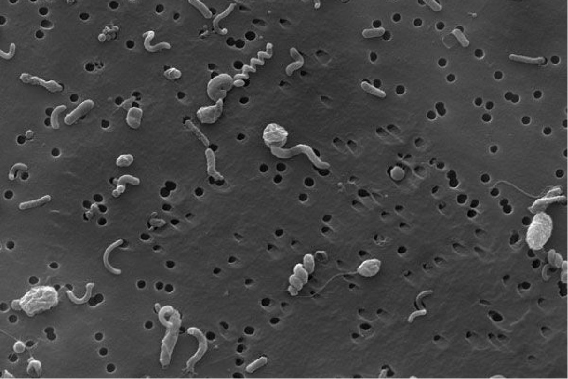 显微镜下细菌形态图片