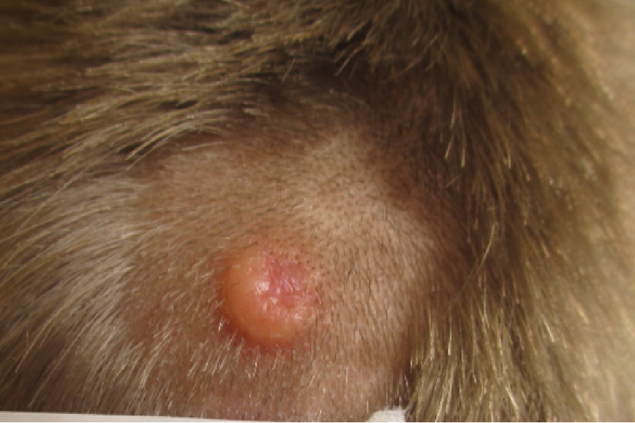 头皮毛母质瘤图