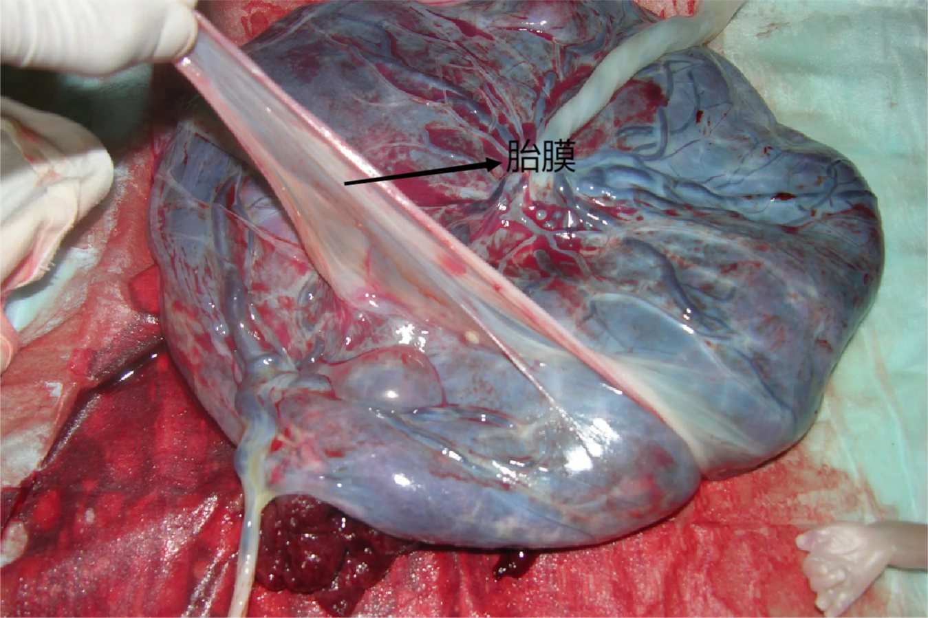 引产后排出的胎膜图片