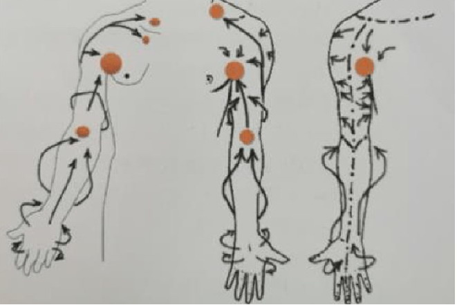 淋巴引流手法图