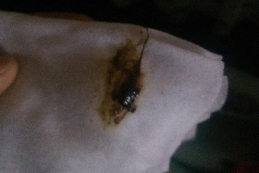 保胎中排黑色渣渣图