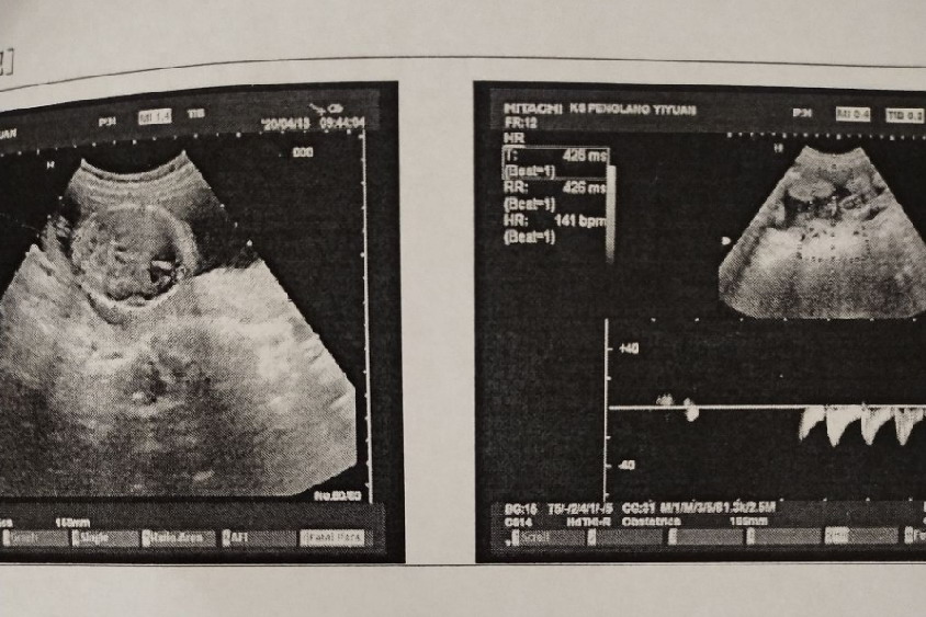 怀孕18周宝宝发育图