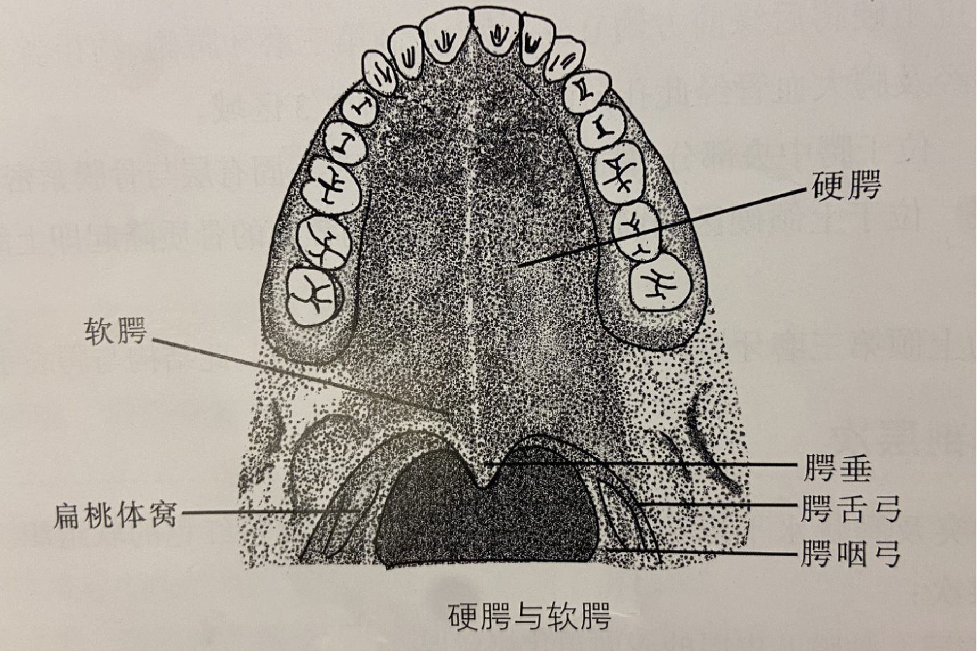 腭舌弓位置图