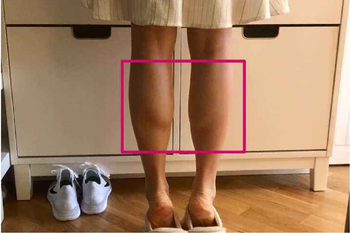 女生腓肠肌发达图