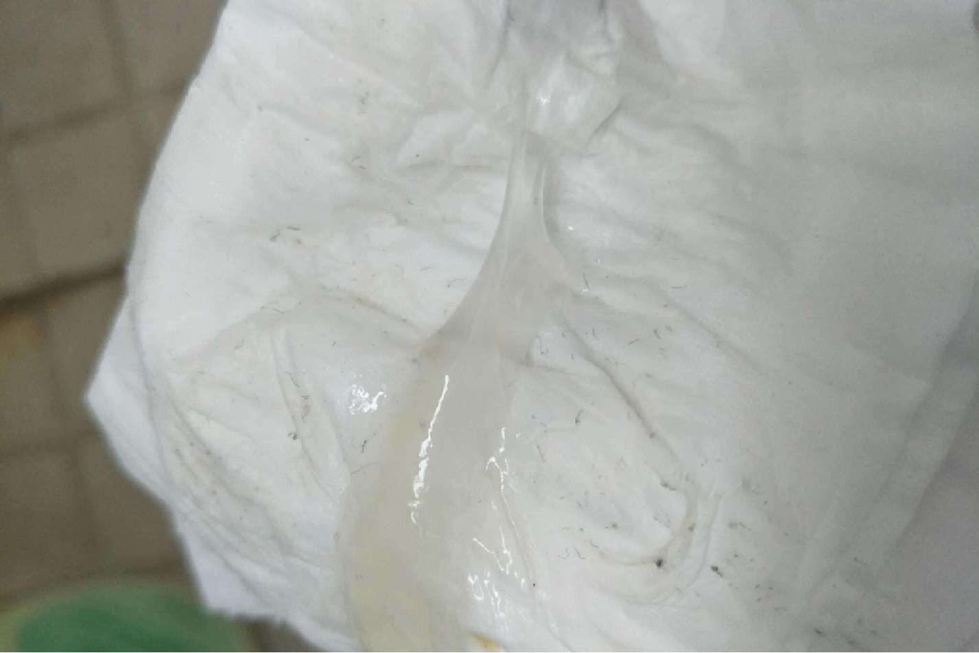 阴道有白色分泌物图片