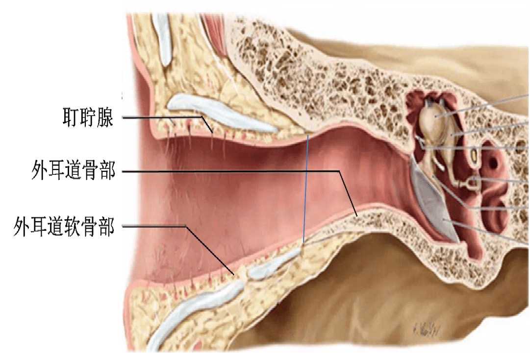 耵聍腺图片