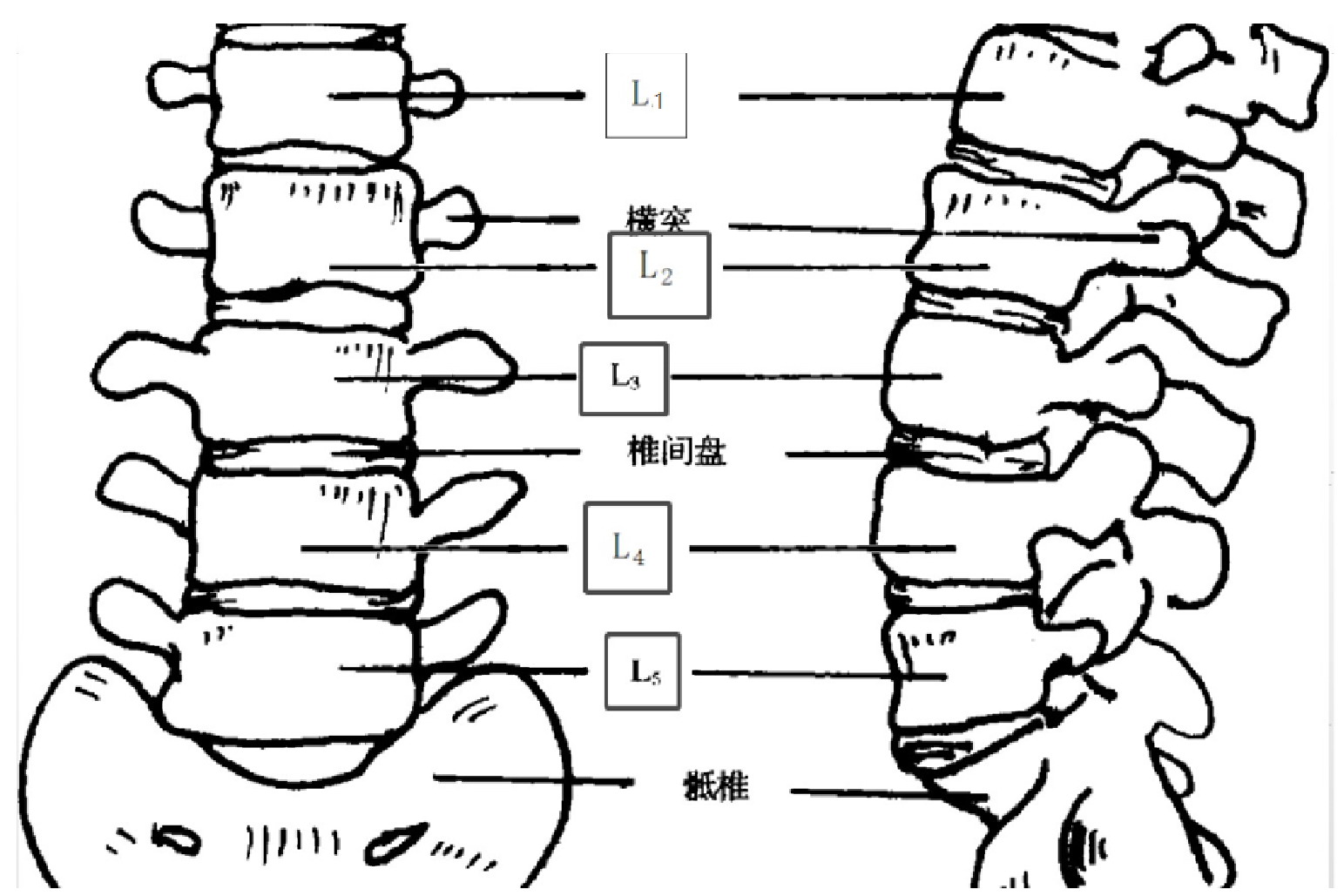 腰椎1-5图片