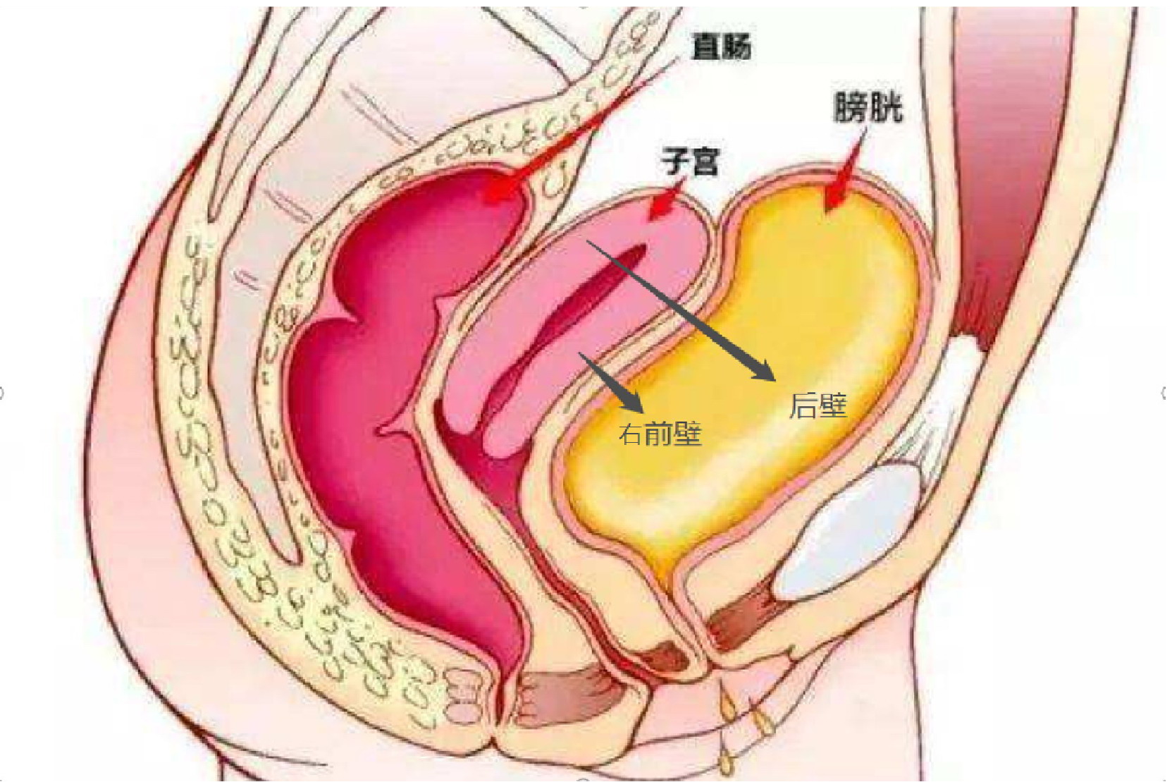 子宫右前壁位置图片